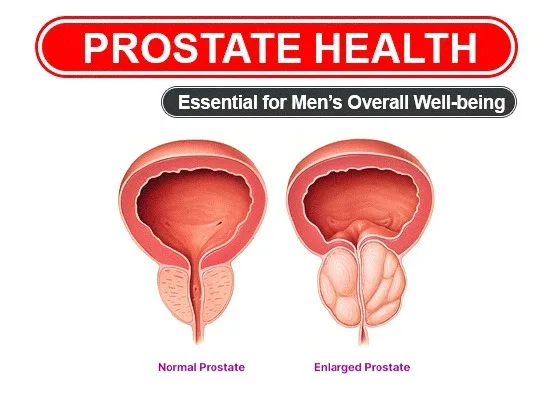 prostadine prostate health